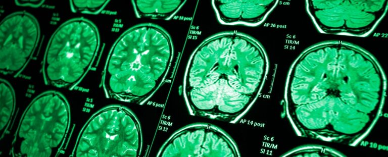 Hidden abnormalities discovered in the brains of elite soldiers: Sciencealert