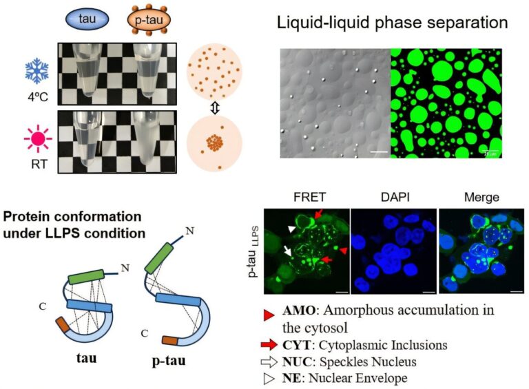 Phosphorylation allows tau protein to form reversible drops, offering ideas about early Alzheimer’s