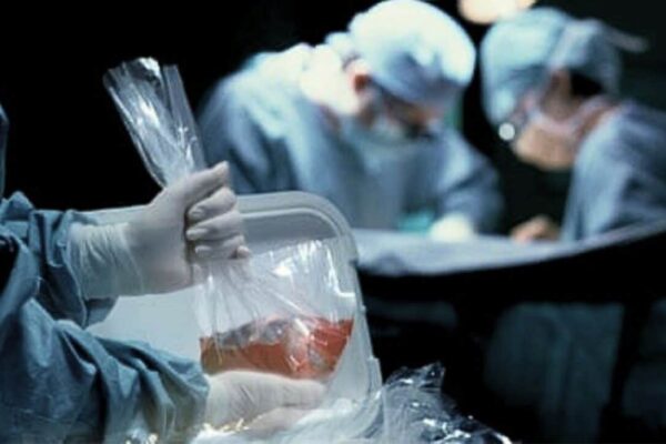 ‘Dead’ man woke up on operating table while his organs were removed and lived to tell the tale
