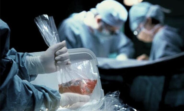 ‘Dead’ man woke up on operating table while his organs were removed and lived to tell the tale