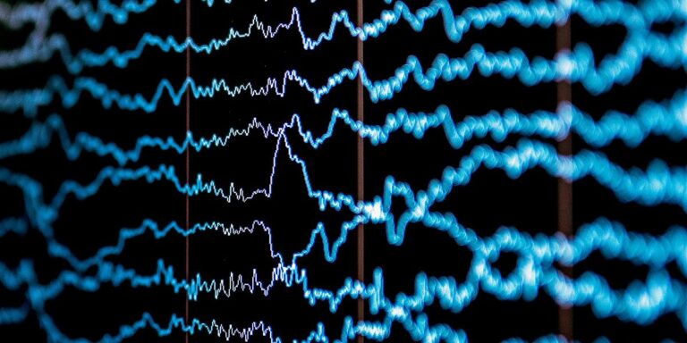 Technology shares pain perception measured by brain waves