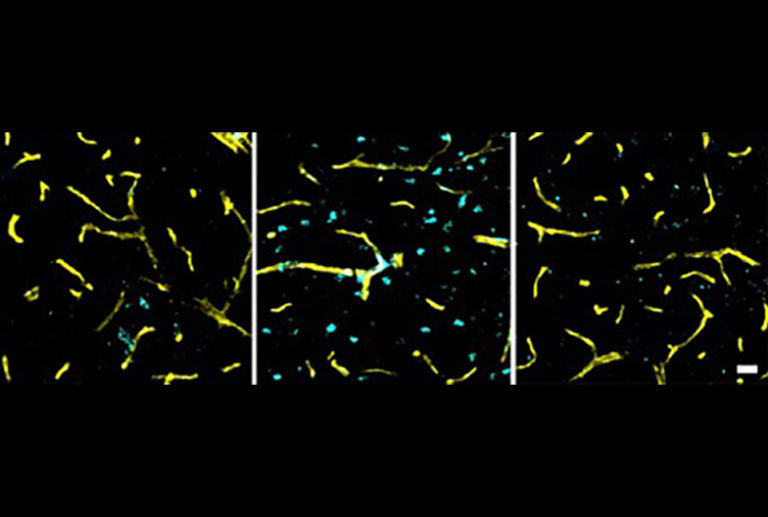 After prediabetes, will the CDC call prehypertension a pandemic?